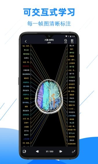 影像解剖图谱app图1